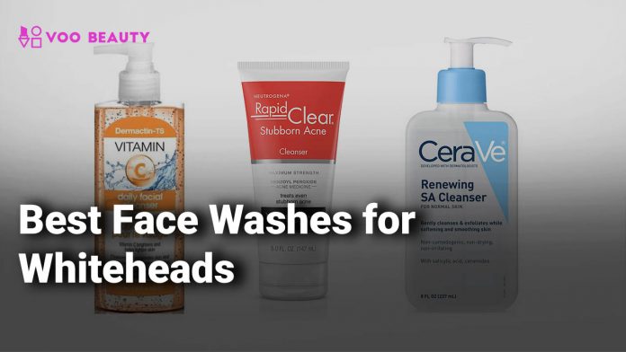 Best Face Washes for Whiteheads